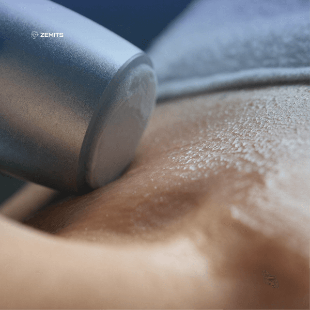 Cryo-Restoration Full Body Sculpt at R&R Aesthetics - Prescott, Arizona in Prescott, AZ