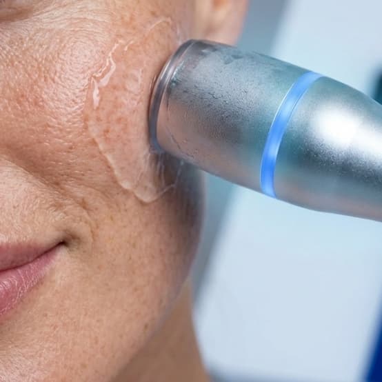 FALL PROMO CRYO-Contour (Face) at R&R Aesthetics - Prescott, Arizona in Prescott, AZ